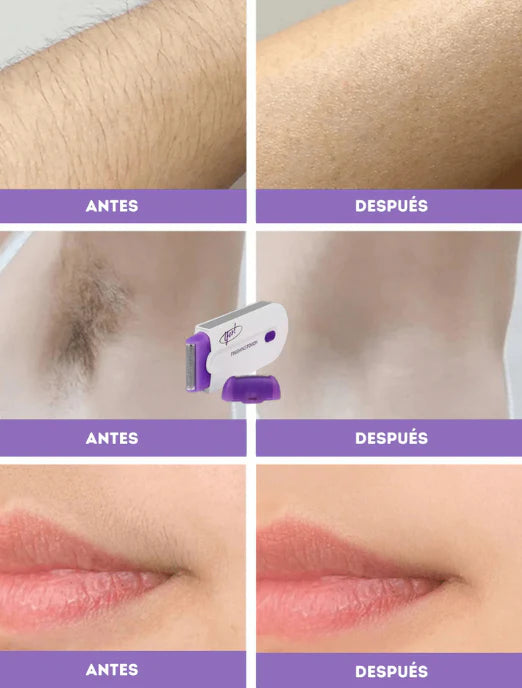 La Depiladora Láser IPL NovaSkin te da minutos de belleza real, sin dolor y sin salir de casa!
