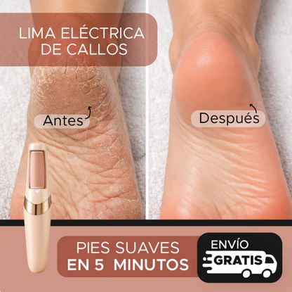 🔥 ¿Hasta cuándo vas a seguir escondiendo tus pies? 🔥