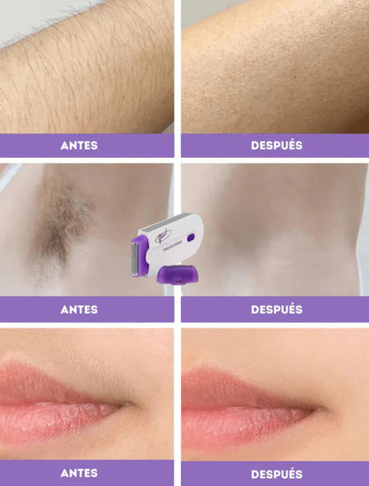 La Depiladora Láser IPL NovaSkin te da minutos de belleza real, sin dolor y sin salir de casa!